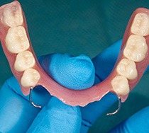 Close-up of a removable denture