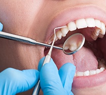 patient getting dental checkup 